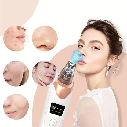 Blackhead Remover - Multipurpose